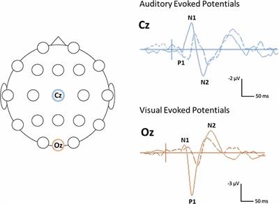 Evoked Potentials and EEG Analysis in Rett Syndrome and Related Developmental Encephalopathies: Towards a Biomarker for Translational Research